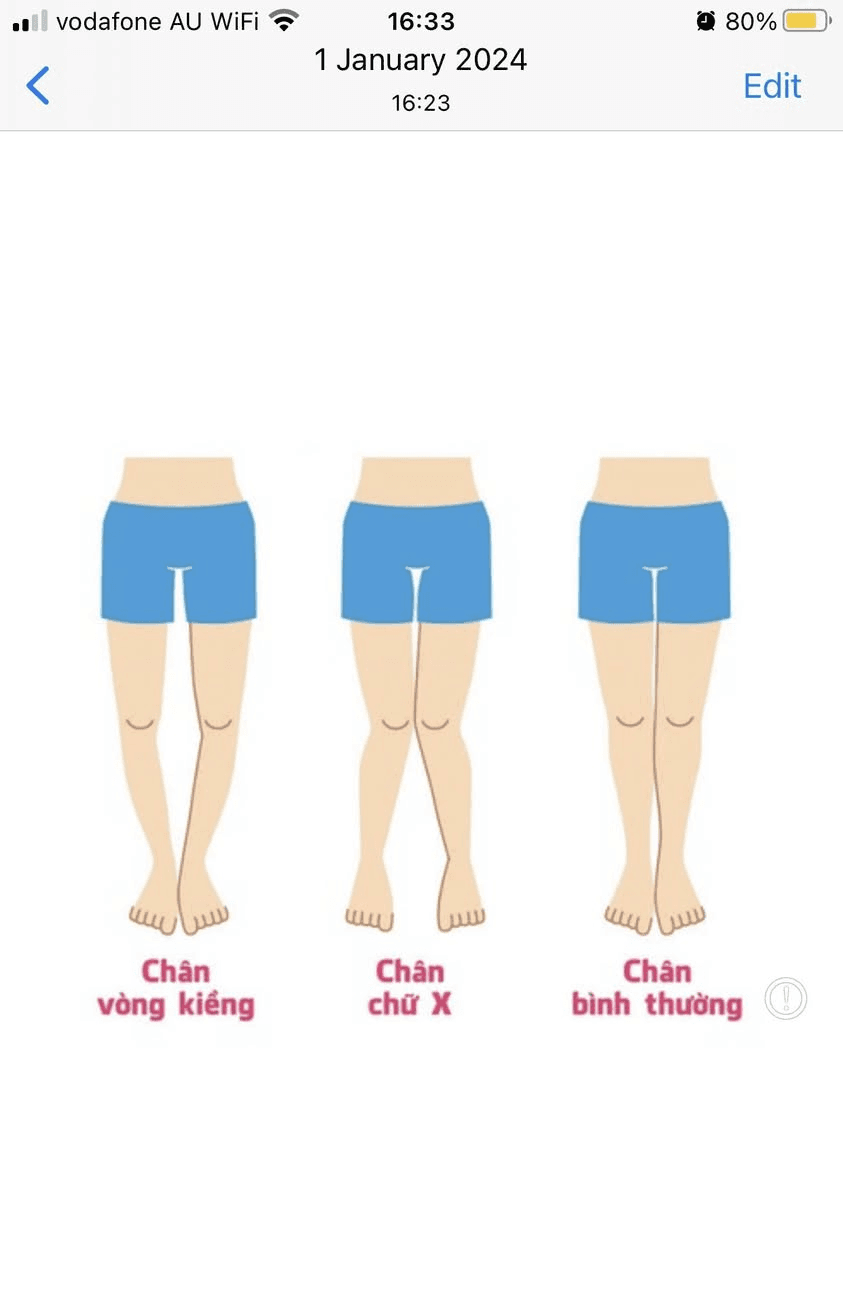 Tại Sao Phải Tập Mạnh Bàn Chân?